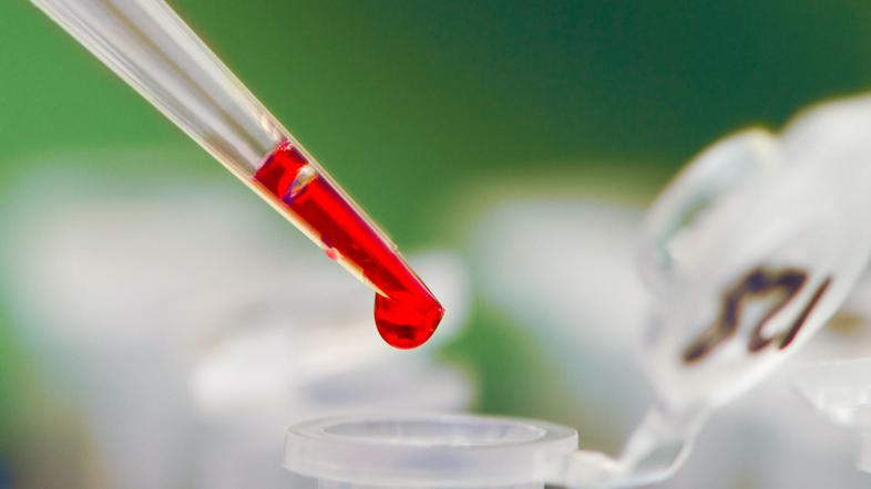 (Foto: Shutterstock)