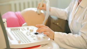 ultrazvok pregled nosečnost