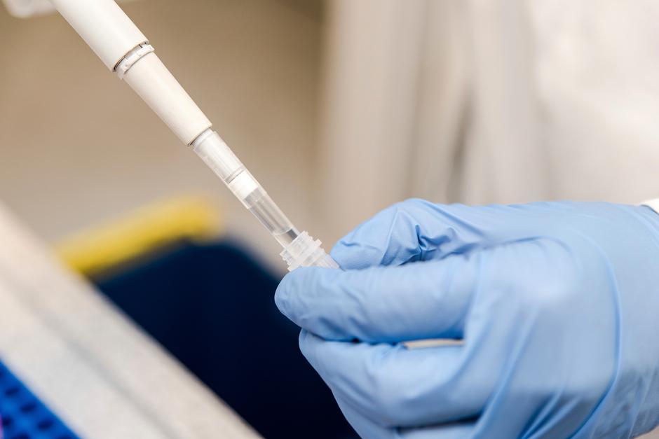 Covid-19 | Avtor: Profimedia