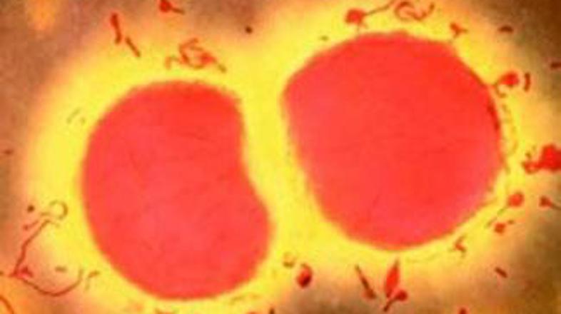 Janet Evgen pravi, da razloga za paniko ni.