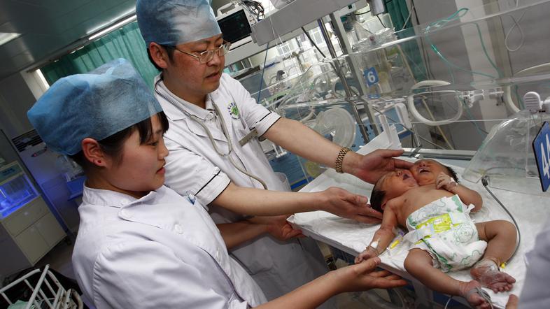 dvoglavi otrok kitajska