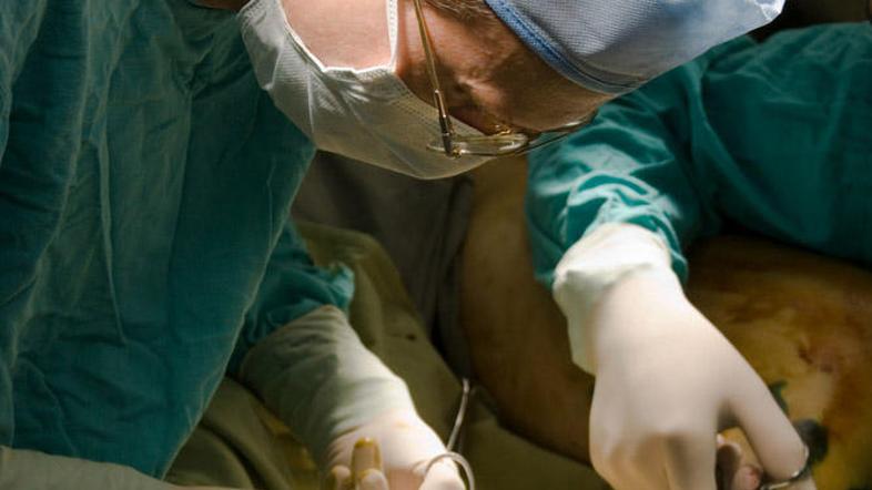 Operacija krčnih žil velja za manj tvegano, pravijo strokovnjaki. (Foto: Shutter