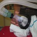 beli kakadu Koki na respiratorju
