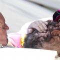 Papež poljubiol bolnika
