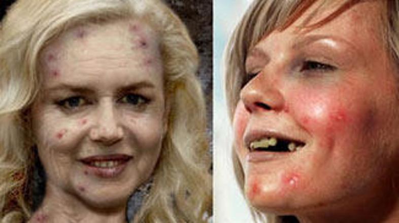 Tudi zvezdniki so lahko grdi.