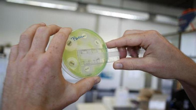 V britanskih bolnišnicah imajo vse več primerov sicer vsakdanjih bakterij, ki so