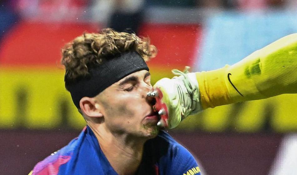 Zvezdnik dobil kopačko v obraz, tla so se obarvala rdeče