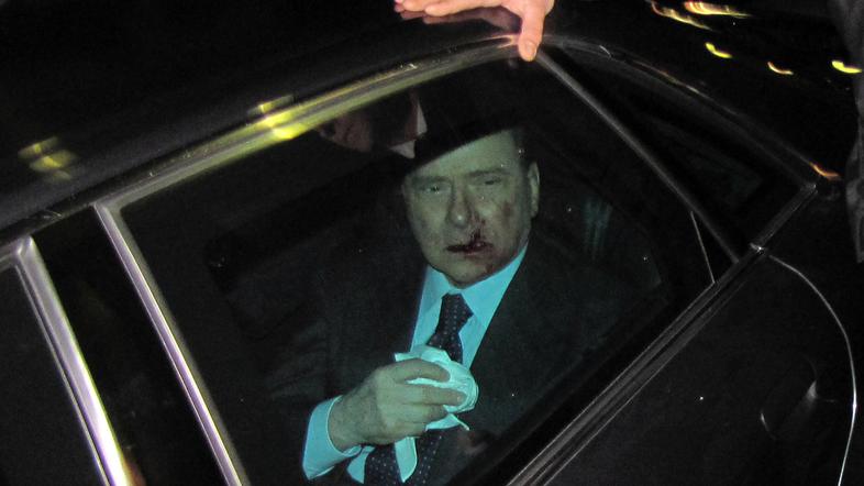 Berlusconi si še vedno ni opomogel od posledic napada. (Foto: EPA)