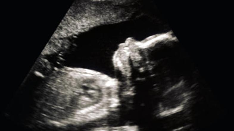 Policija sklepa, da je otrok še živ.