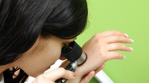 Na pregled pojdite, kadar opazite sumljive spremembe, opisane v ABCDE-sistemu, a