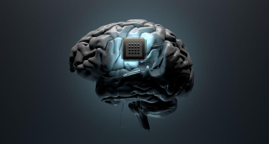 Neuralink možgani čip | Avtor: Profimedia
