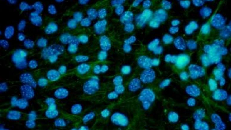 Z manipulacijo genov lahko znanstveniki vplivajo na delitev kožnih celic.