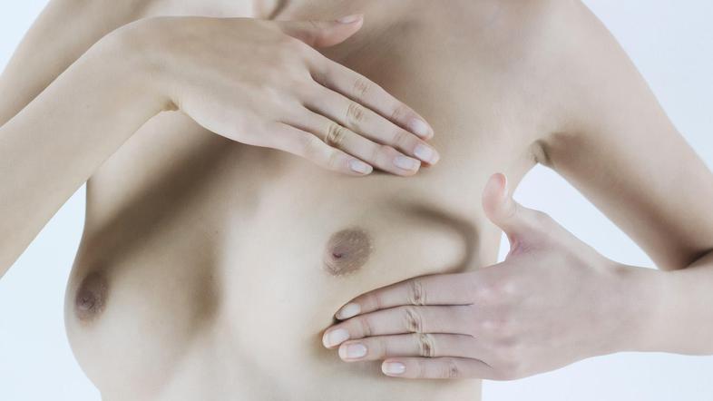 Ženske, starejše od 50 let, bi morale mamografijo opraviti vsaki dve leti.