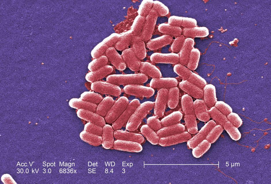 E. coli | Avtor: Profimedia