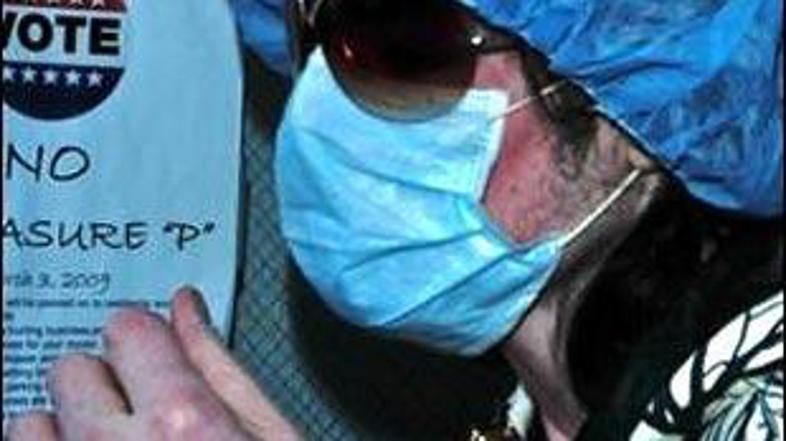 Pevec je imel pred kratkim dve plastični operaciji.