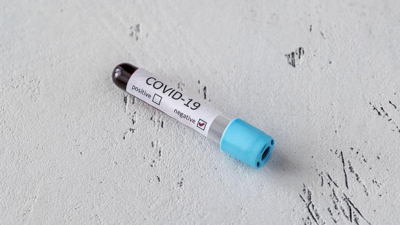 Covid-19 test vzorec korona