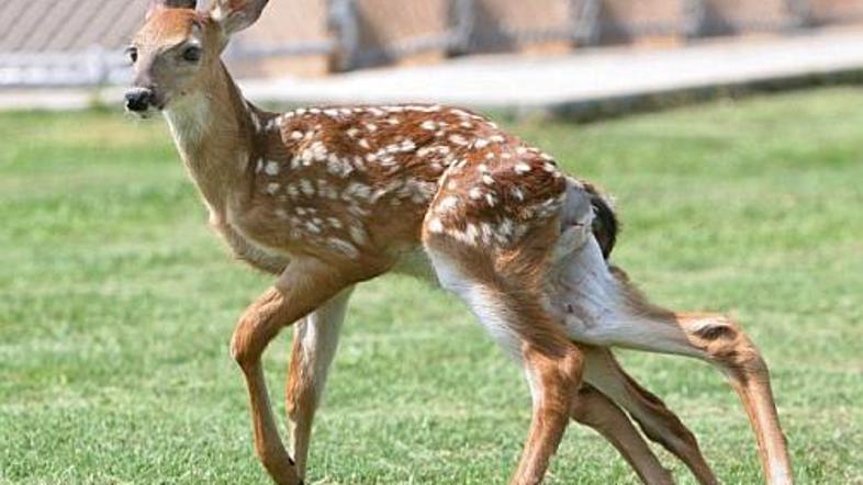 Malček se je zaradi šestih nog znašel na naslovnicah.
