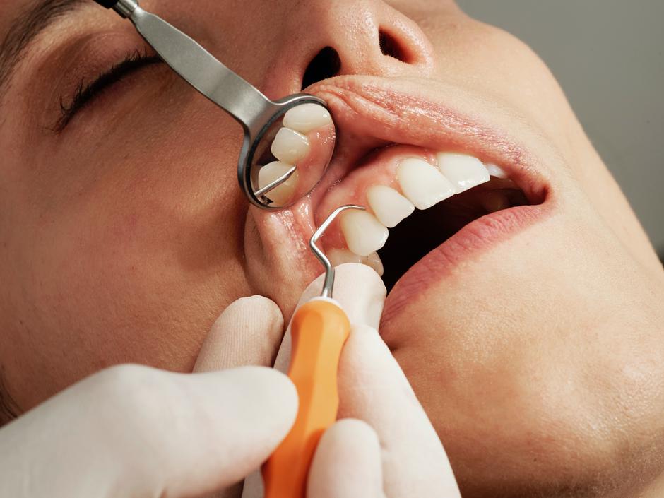 zobozdravnik, zob, higiena | Avtor: Unsplash