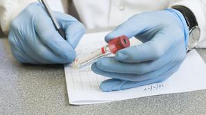 Testiranje na covid-19