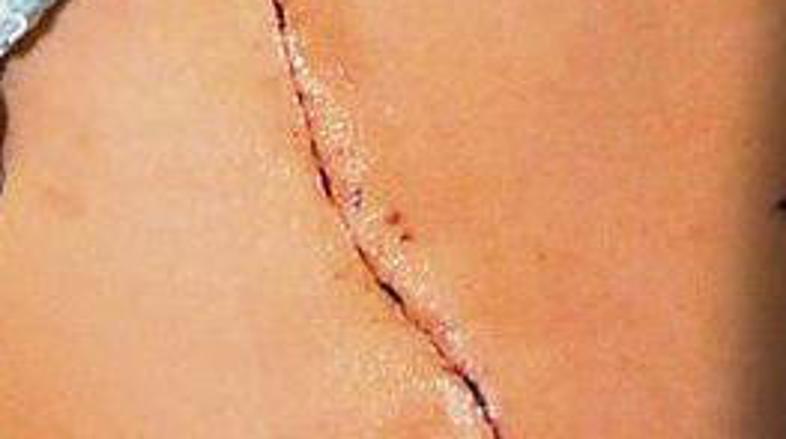 Janin je povedala, da to, kar ji je storil Martin, ni lepo, a da ga kljub temu š