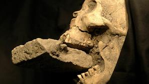 Lobanja ženske, ki so jo imeli za krvosesinjo in ji v ustno votlino porinili kam