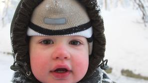 Zivljenje 13.02.14. otrok, dermatitis foto: shutterstock 