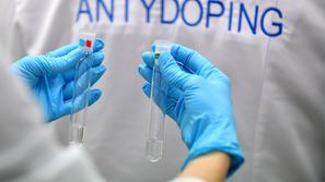 doping test