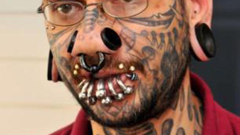 Rouslan Toumaniantz bo najstnici plačal stroške laserske operacije.