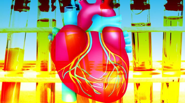 Hiperholesterolemija