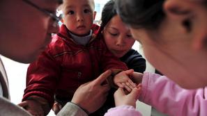 Otrok na Kitajskem pri zdravniku