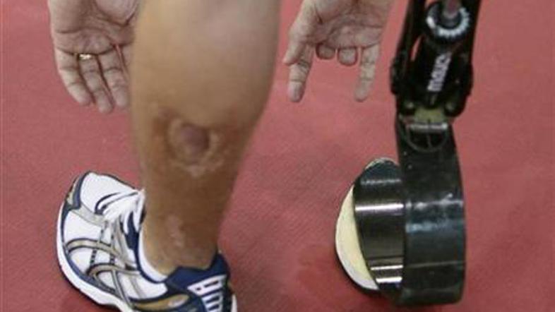 Z novo tehniko zdravljenja prihaja upanje, da bi tovrstne terapije omogočile hud