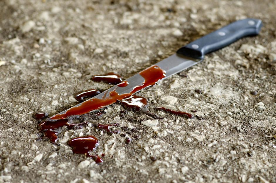 Krvav nož (slika je simbolična) | Avtor: Sutterstock