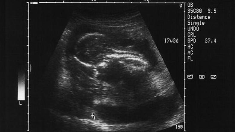 Genetični inštitut v Virginiji je bil eden prvih zdravstvenih centrov v ZDA, ki 