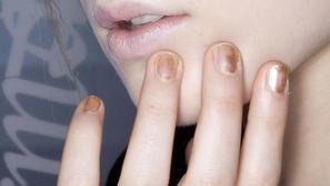 Tudi kratki nohti so lepi, a le, če so negovani. (Foto: Imaxtree)