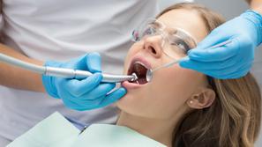 zobje, zavarovanje, zobozdravnik