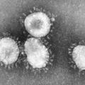 Koronavirusi