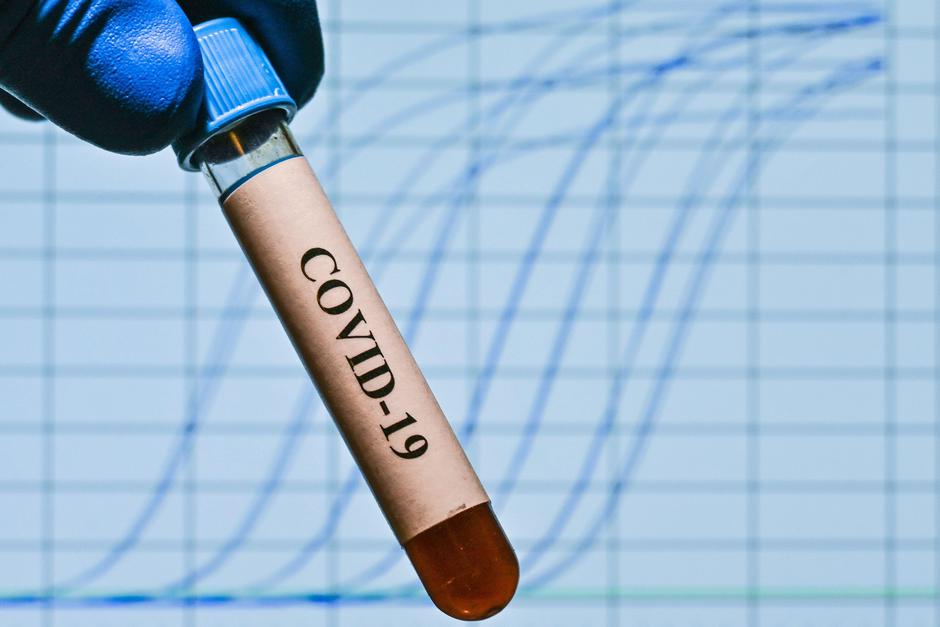 Covid-19 | Avtor: Profimedia