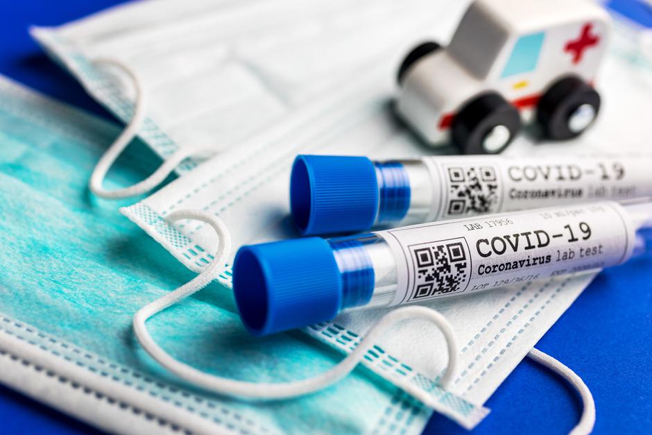 Novi koronavirus | Avtor: Profimedia