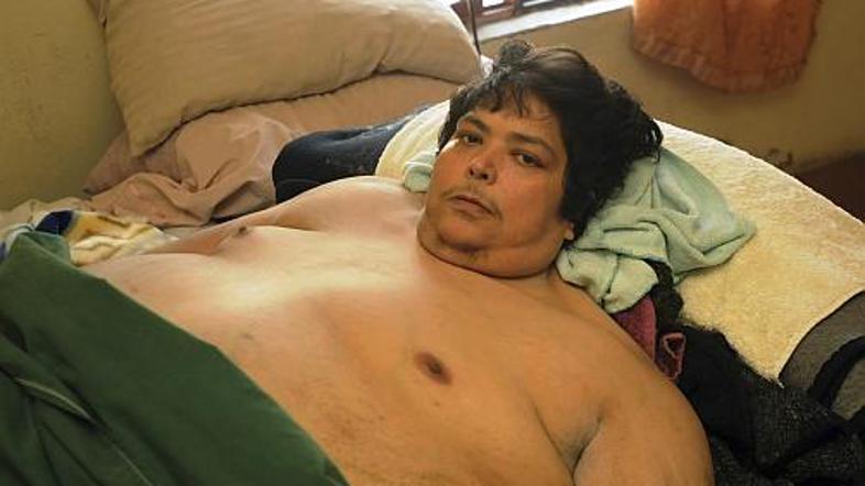 Jose Luis Garza je imel od nekdaj težave s prehranjevanjem.