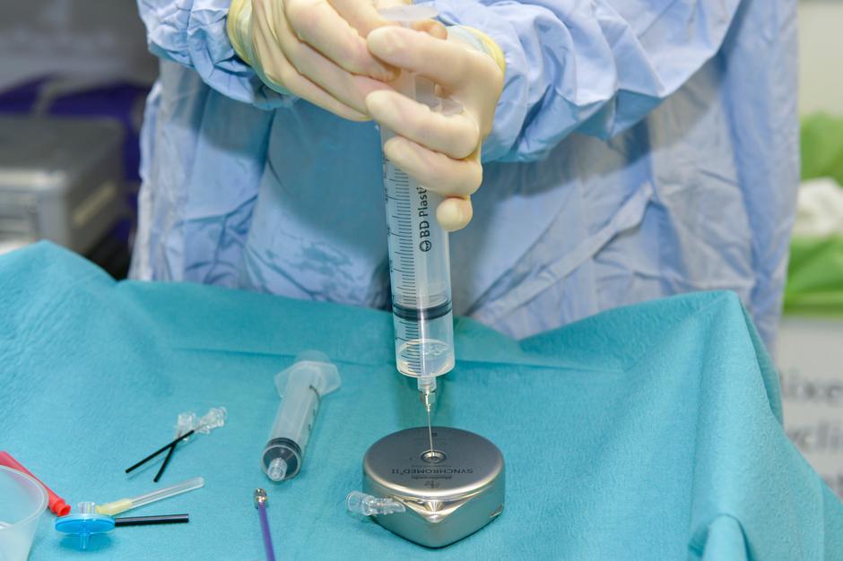 Multipla skleroza | Avtor: Profimedia