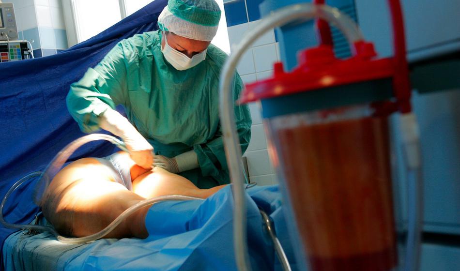 Tragična novica iz Turčije, zato je umrla 44-letna Slovenka