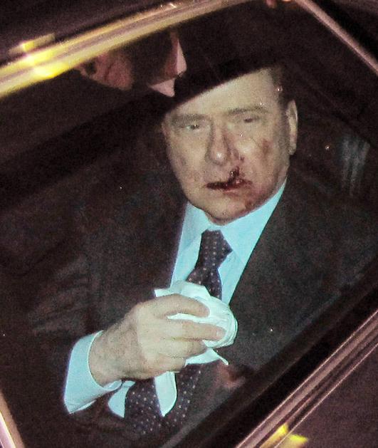Berlusconi po napadu. (Foto: EPA)