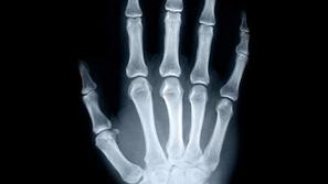 Ko se bodo rešitve vojske začele uporabljati v vseh bolnišnicah, bodo hude poško