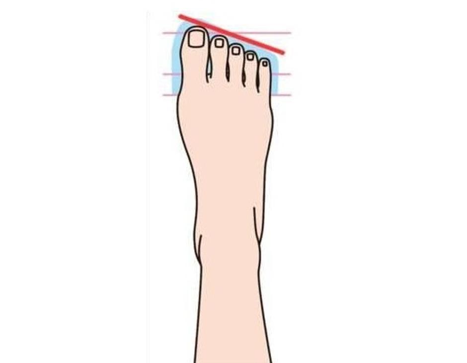 Длинный палец на ноге мужчины. Длинный указательный палец на ноге. Пальцы на ногах одинаковой длины. Безымянный палец на ноге длиннее. Греческая форма стопы.