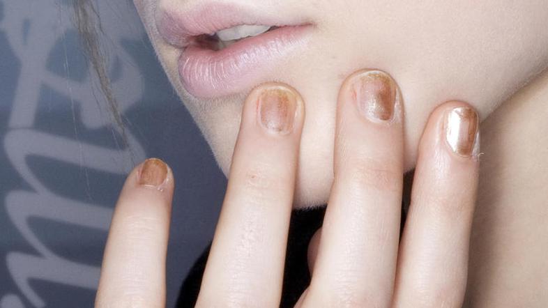 Tudi kratki nohti so lepi, a le, če so negovani. (Foto: Imaxtree)