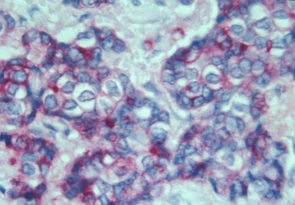 Rakave celice | Avtor: Profimedias