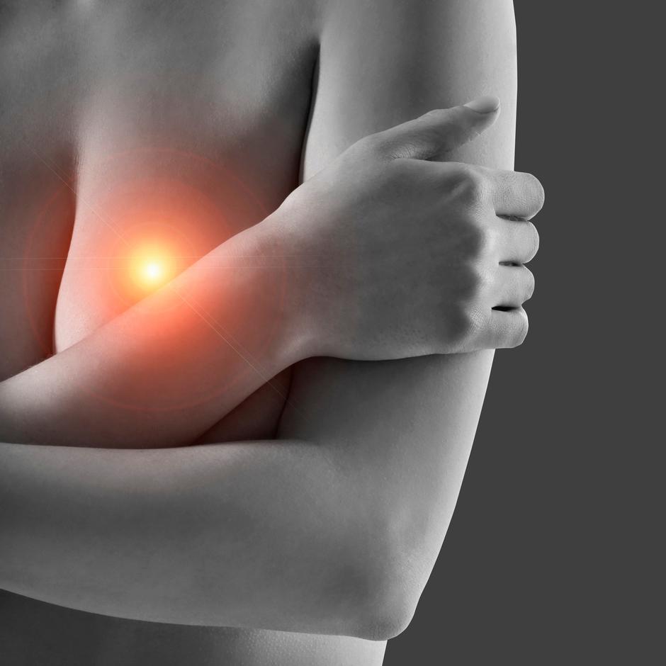 rak dojke | Avtor: Profimedia