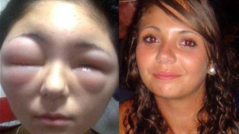 Najstnica je imela srečo v nesreči. (Foto: The Sun)