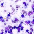 Trypanosoma cruzi